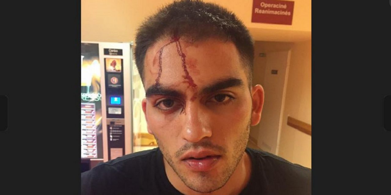 Israeli student brutally attacked in Lithuania in anti-Semitic attack