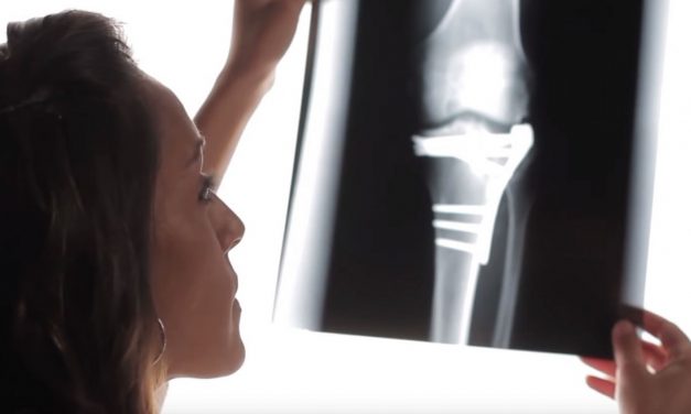 WATCH: Israel performs first knee replacement using CORAL-BASED implant that regrows cartilage