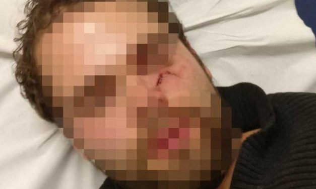 Israeli beaten unconscious for speaking Hebrew on Paris Metro