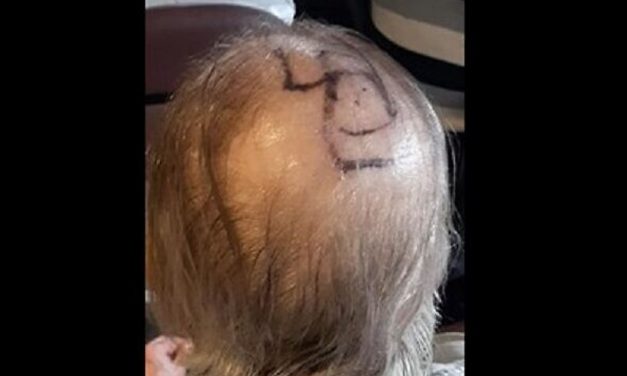 Care home resident with Alzheimer’s and Parkinson’s has swastika drawn on his head – family shocked