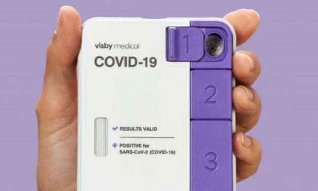 Israeli start-up receives FDA approval for Covid testing kit that give results in 30 minutes