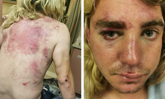 Israeli dogwalker attacked by Palestinian mob during Jerusalem riots