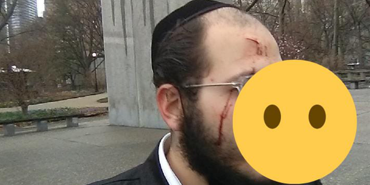 New York: Knifeman slashes faces of Jewish baby and parents