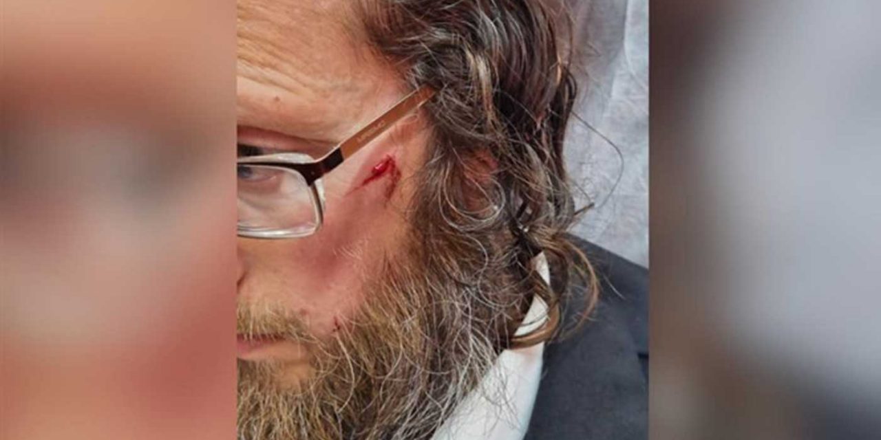 Jewish man assaulted by anti-Semitic mob in Jerusalem